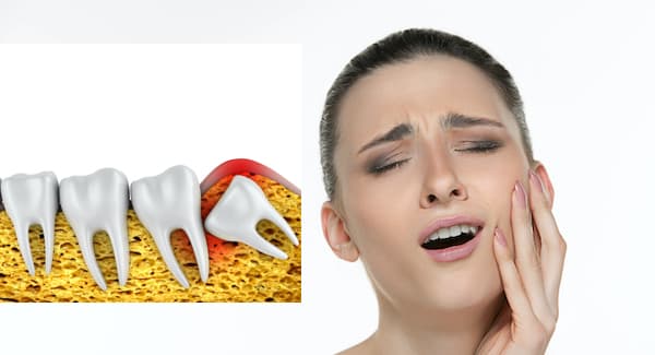 wisdomtooth pain